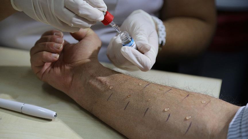 Türkiye’de toplumun yüzde 20’si alerjik belirtiler gösteriyor